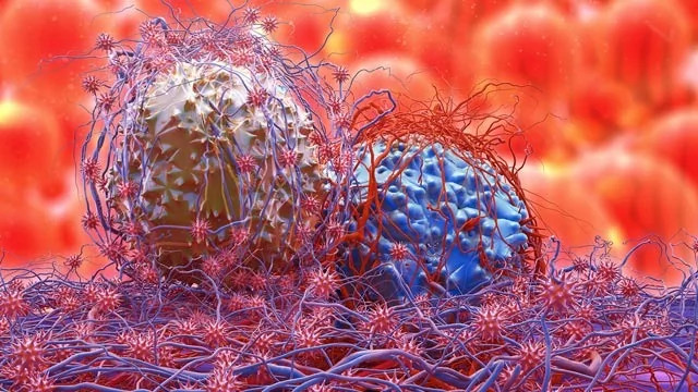 Sconfiggere il tumore con anticorpi bispecifici