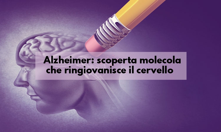 Alzheimer nuova scoperta: una molecola blocca la malattia