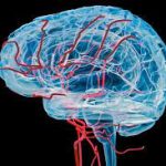Alzheimer e riduzione vasi sanguigni