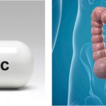 Cause del cancro al colon: nuova scoperta su ruolo degli antibiotici