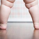 Obesità neonatale legata al sonno