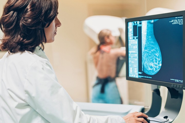 Screening prevenzione tumore al seno: novità 2022