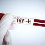 Nuova variante VB HIV