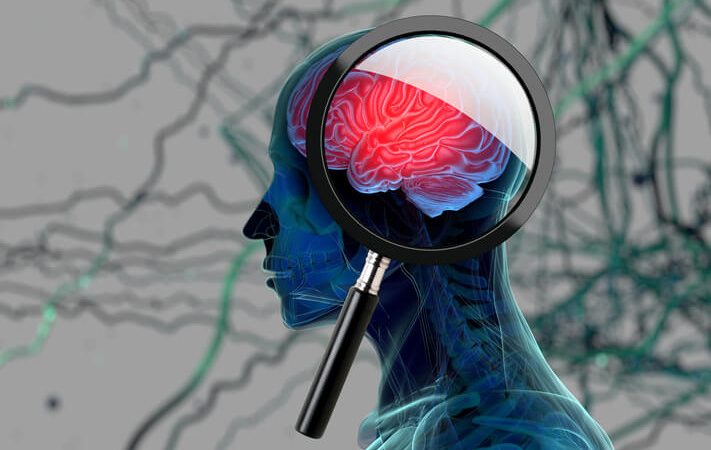 Nuovi studi farmaci Alzheimer Parkinson 2022
