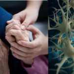 Parkinson nuove cure 2022: impianto di cellule staminali