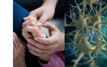 Parkinson nuove cure 2022 con staminali
