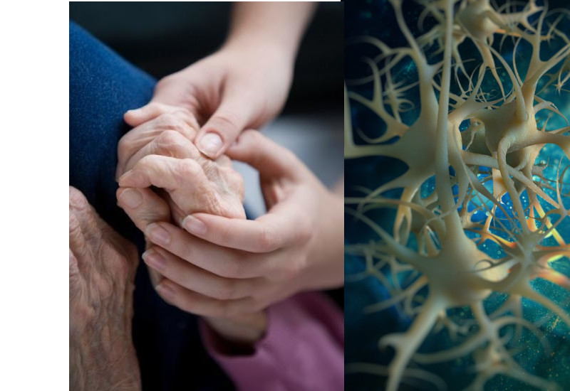 Parkinson nuove cure 2022: impianto di cellule staminali