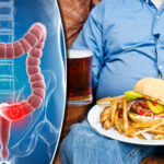 Cancro al colon il cibo che aumenta il rischio: alimenti ultra lavorati associati a maggior incidenza