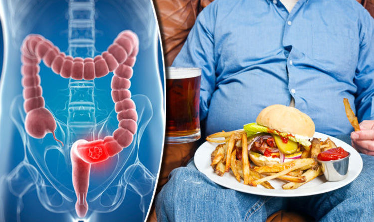 Cancro al colon il cibo che aumenta il rischio: alimenti ultra lavorati associati a maggior incidenza