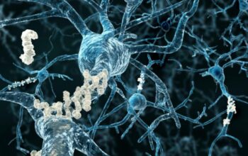 Alzheimer nuove scoperte cause beta amiloide solubile