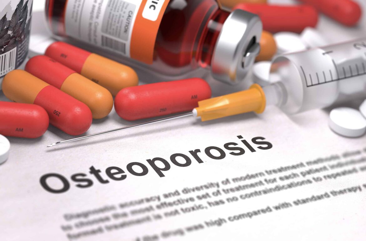 Farmaci ritirati a base di vitamina D per l’osteoporosi: Alendronato e Colecalciferolo