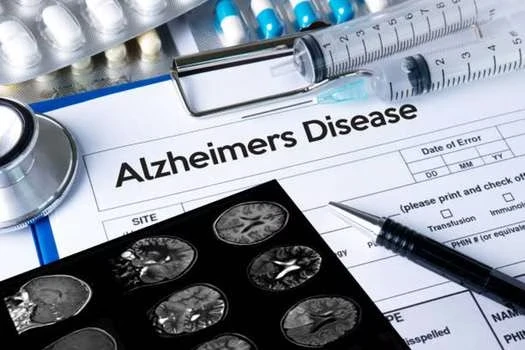 Donanemab nuovo farmaco Alzheimer 2023: risultati promettenti