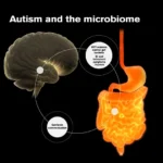 Autismo correlazione intestino microbiota