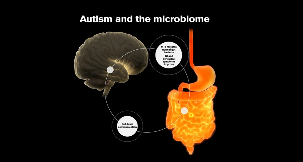 Correlazione fra autismo e microbiota intestino: nuovo studio conferma legame