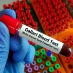 Galleri esame del sangue per scoprire 50 tipi di cancro