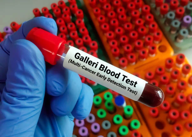 Galleri: l’esame del sangue per scoprire oltre 50 tipi di tumori