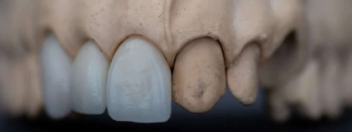 Presto possibile ricrescita denti negli adulti: il farmaco sarà testato nel 2024