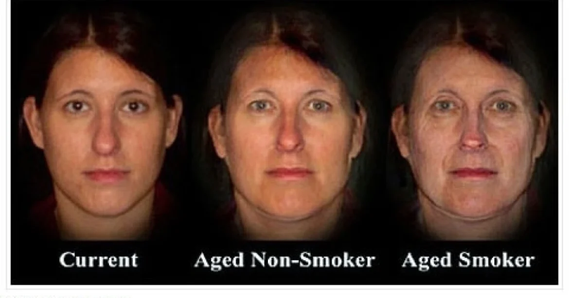 Fumare fa invecchiare prima: la conferma da uno studio sul DNA
