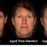 Fumare fa invecchiare velocemente accorcia telomeri