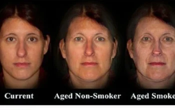 Fumare fa invecchiare velocemente accorcia telomeri