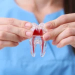 Evitare devitalizzazione dente con la rigenerazione tessuti