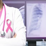 Test saliva diagnosi precoce tumore al seno